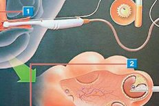 2026美国三代试管婴儿筛查费用多少？