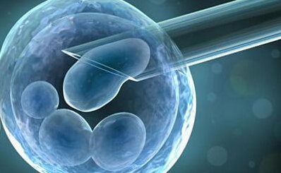 多囊卵巢做哪种运动好？什么样的运动适合多囊卵巢？